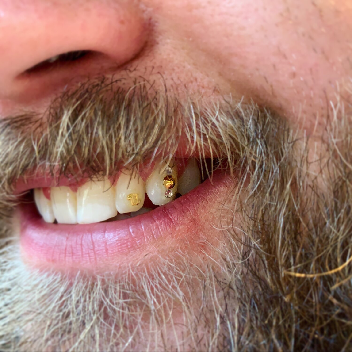 TOOTH GEMS — Saint Louis Tattoo Artist/Nikole Knebel