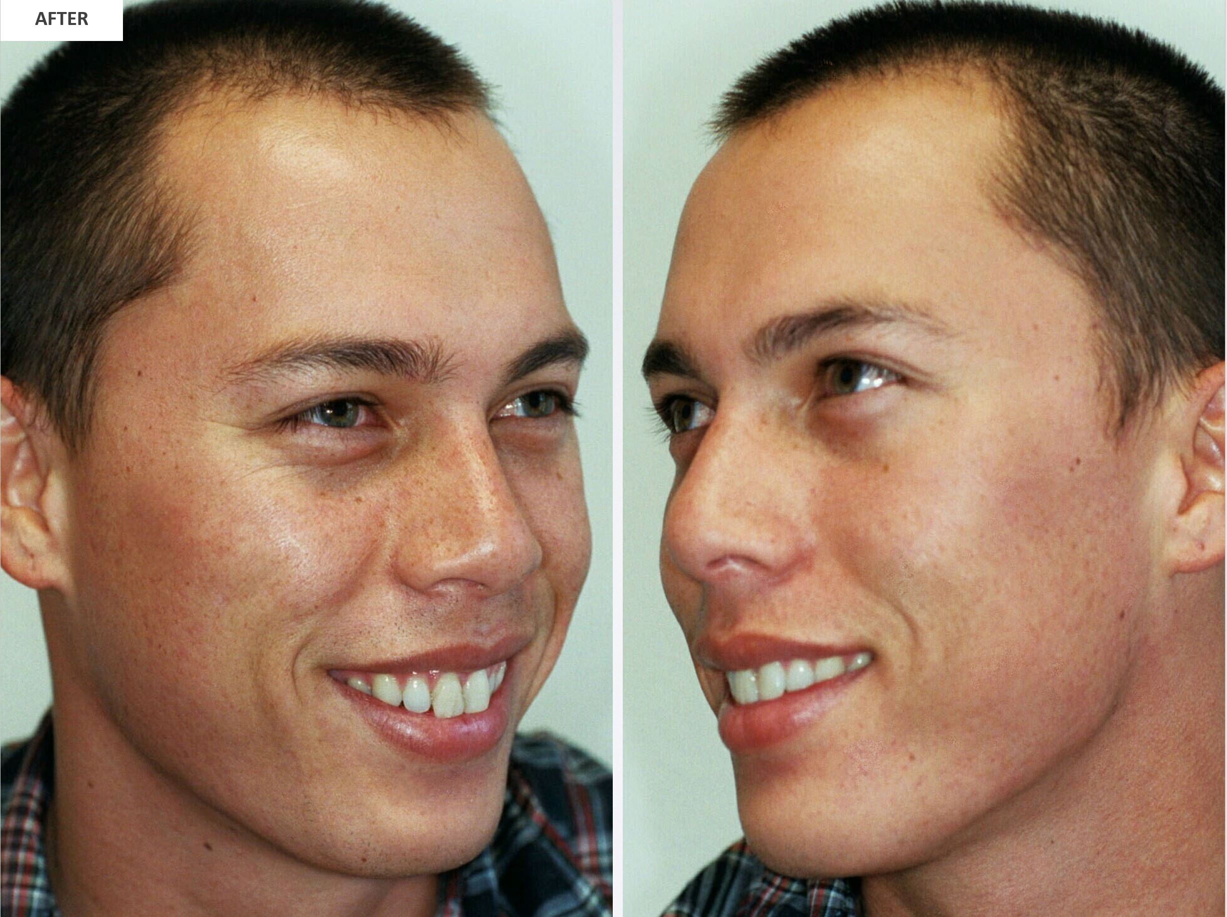 Villani Treatment™