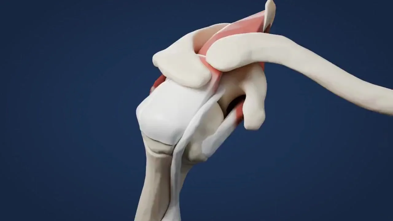 Do I Need Surgery for a Rotator Cuff Tear?