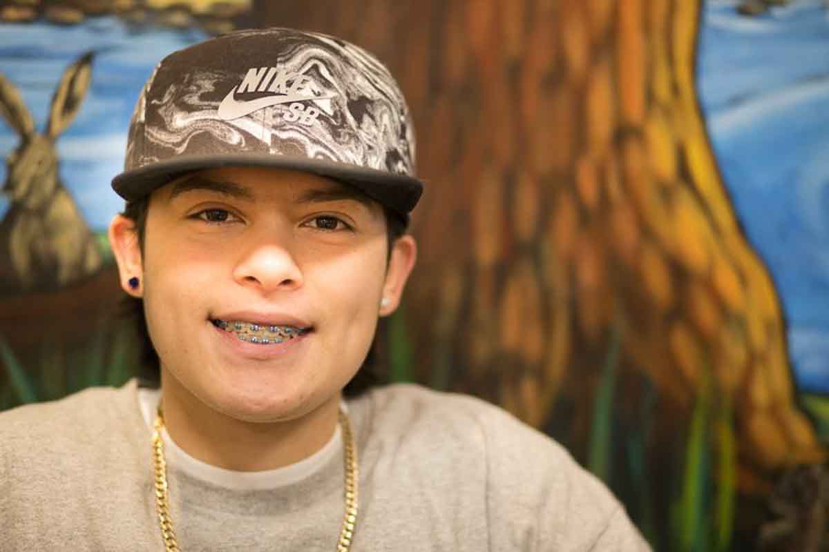 Braces-2.jpg