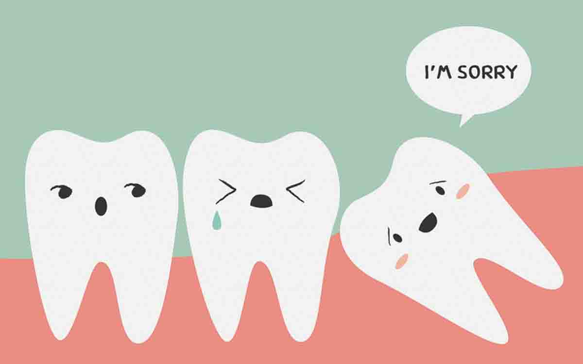 Braces png-2.jpg