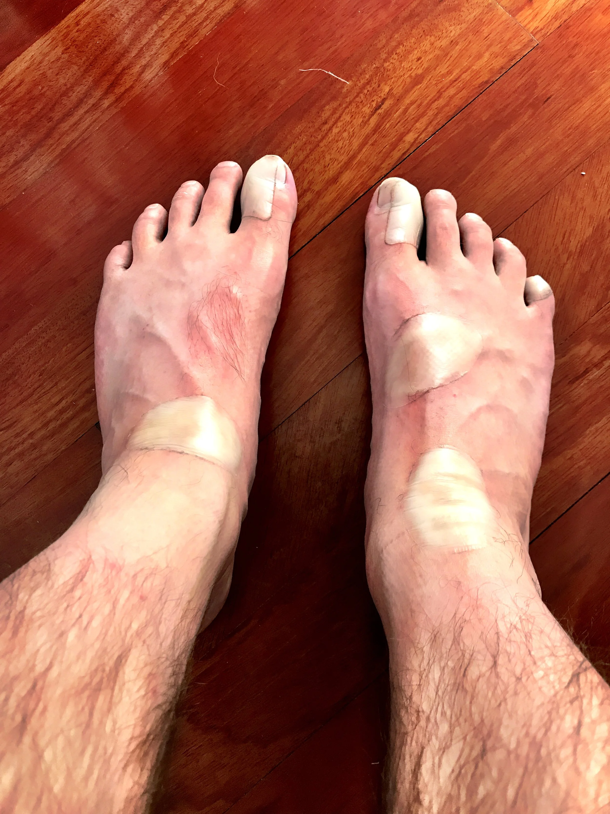 The Suspicious Feet