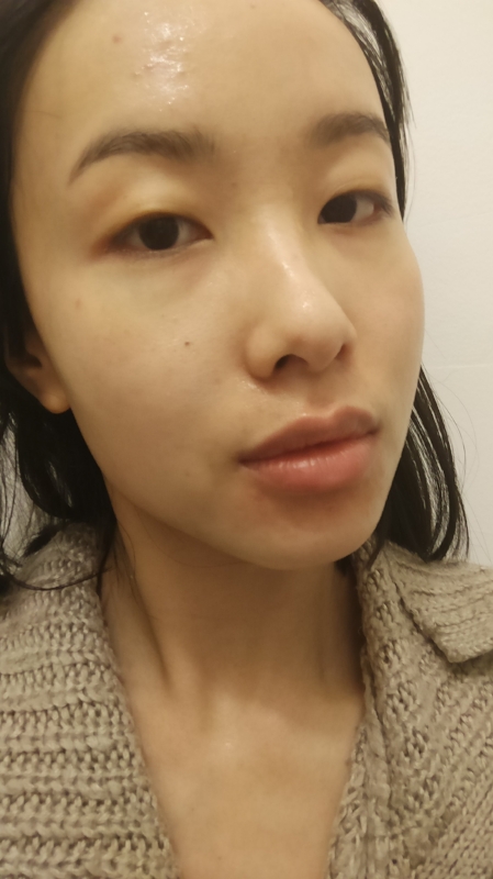 Shoot day, after I removed all my makeup and cleansed my face. There is a layer of moisture from using left-over facemask products on my face