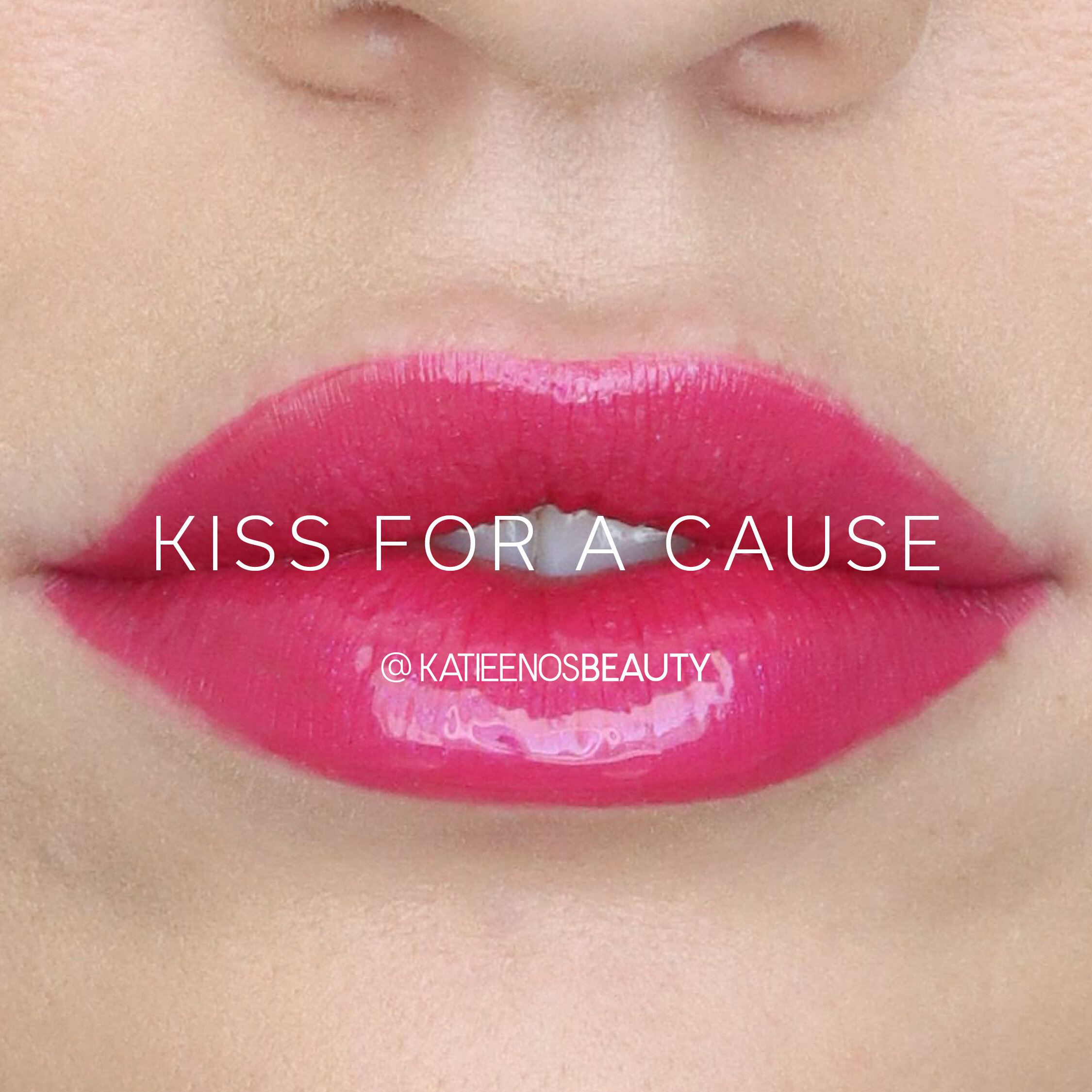 KISS FOR A CAUSE