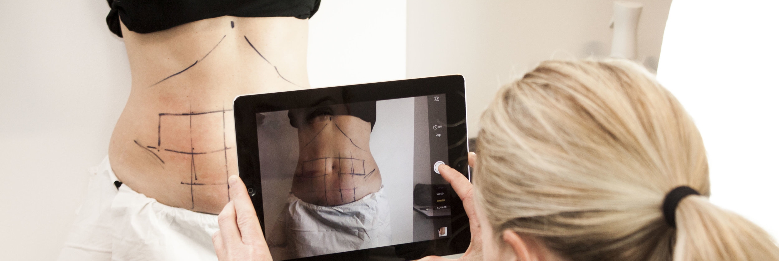 Post Pregnancy Tummy Treatments London.jpg