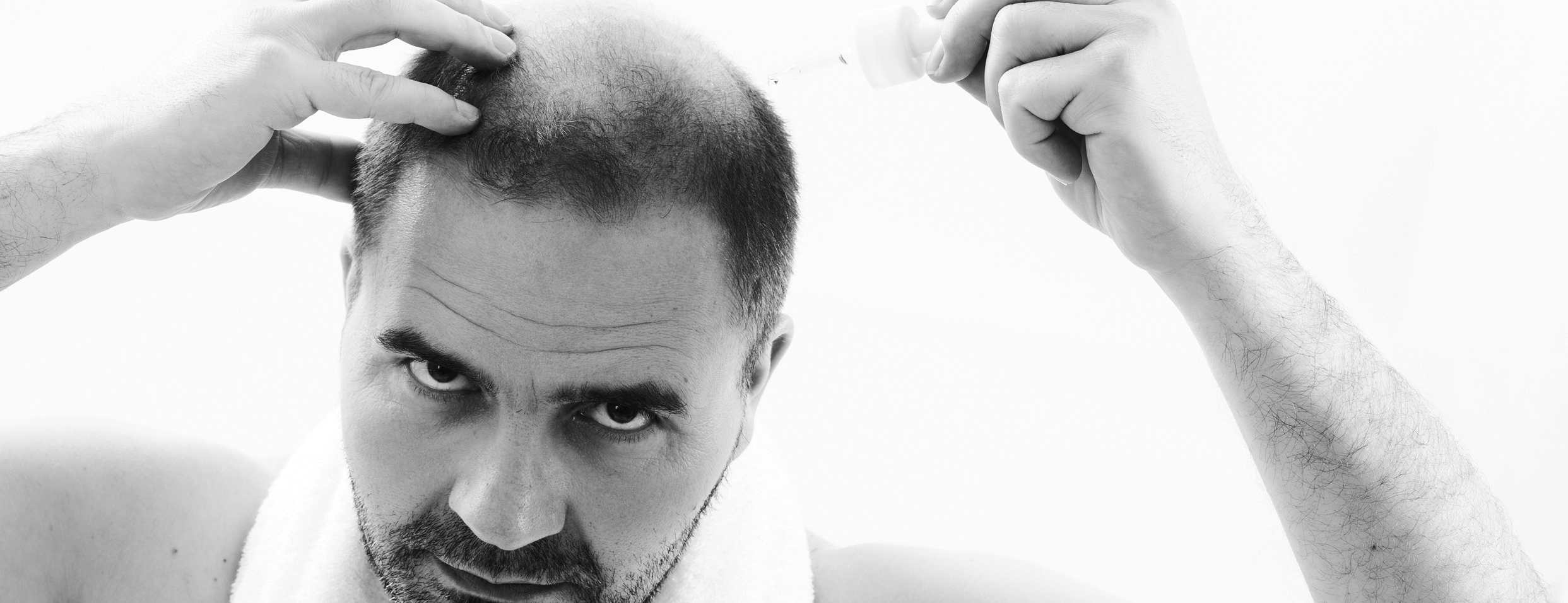 Hair Loss.jpg
