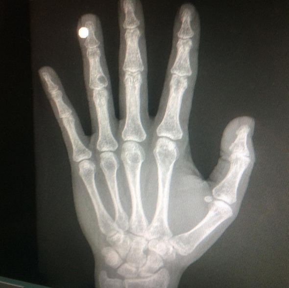 Ethics of Biohacking