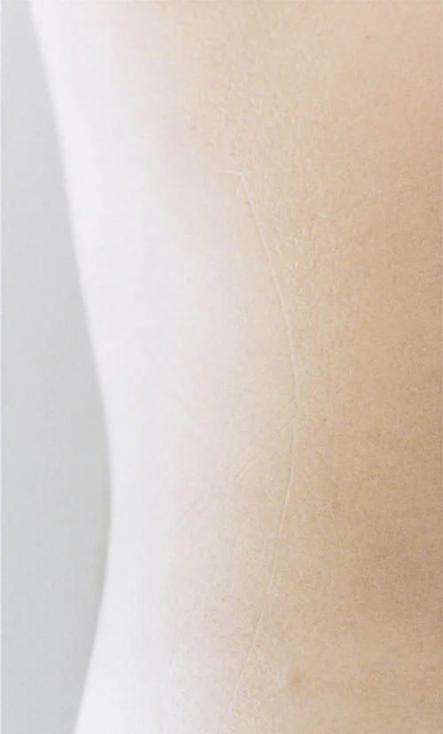 skin 1 (CY) 2002-2018 archival pigment print on matte photo tex 22 x 13 inches edition of 5 + 2 A/P