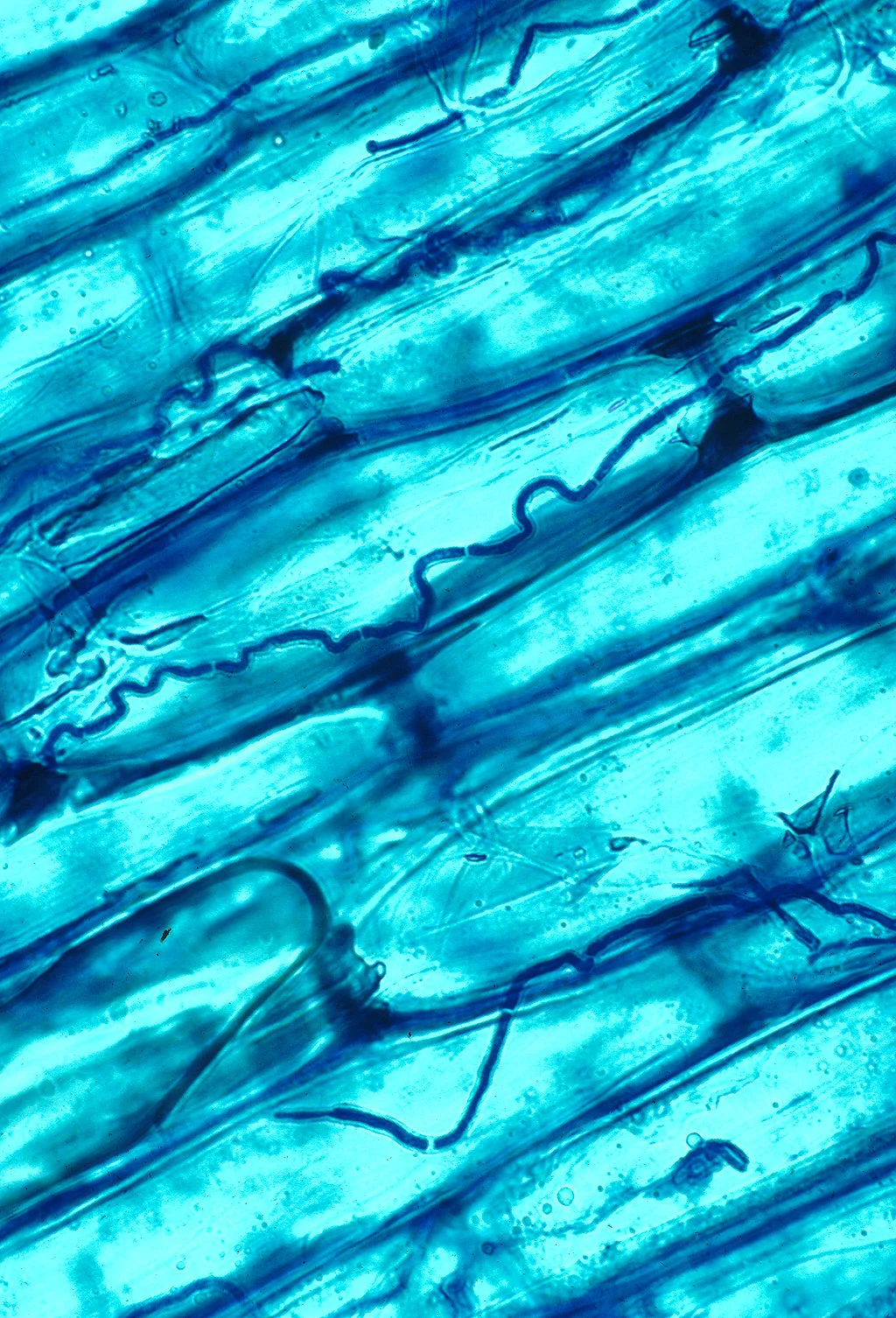 Fungal endophyte Epichloë coenophiala . 