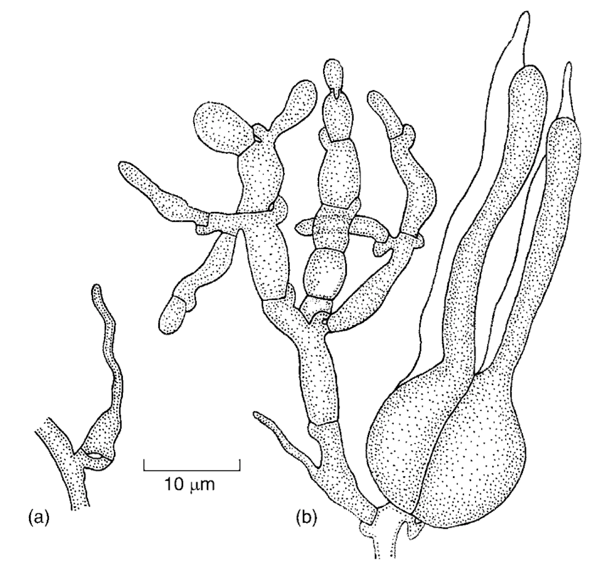 A jelly fungus edition of Fungi Friday Tremella foliacea