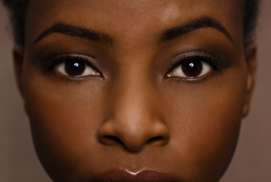 Hyperpigmentation: The REAL Phantom Menace