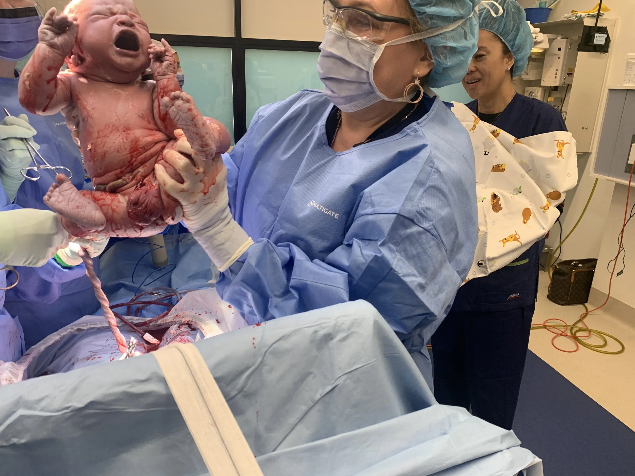 All About Caesarean Sections