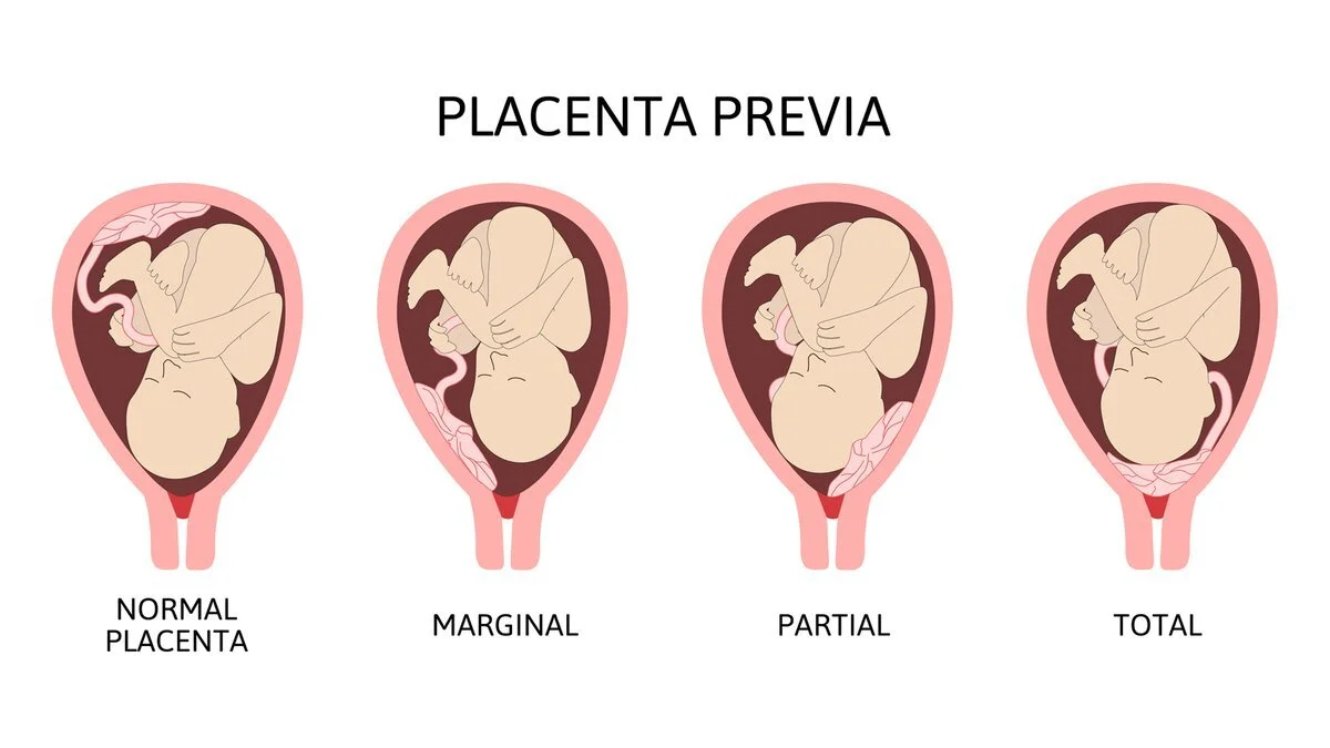 Melbourne Obstetrician Melbourne Gynaecologist