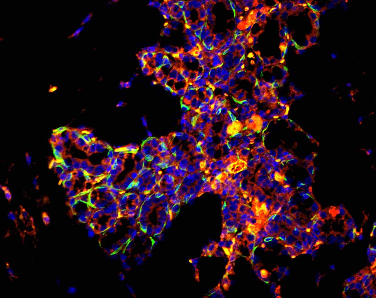 68 H3_(DAPI+GFP+Texasred).JPG