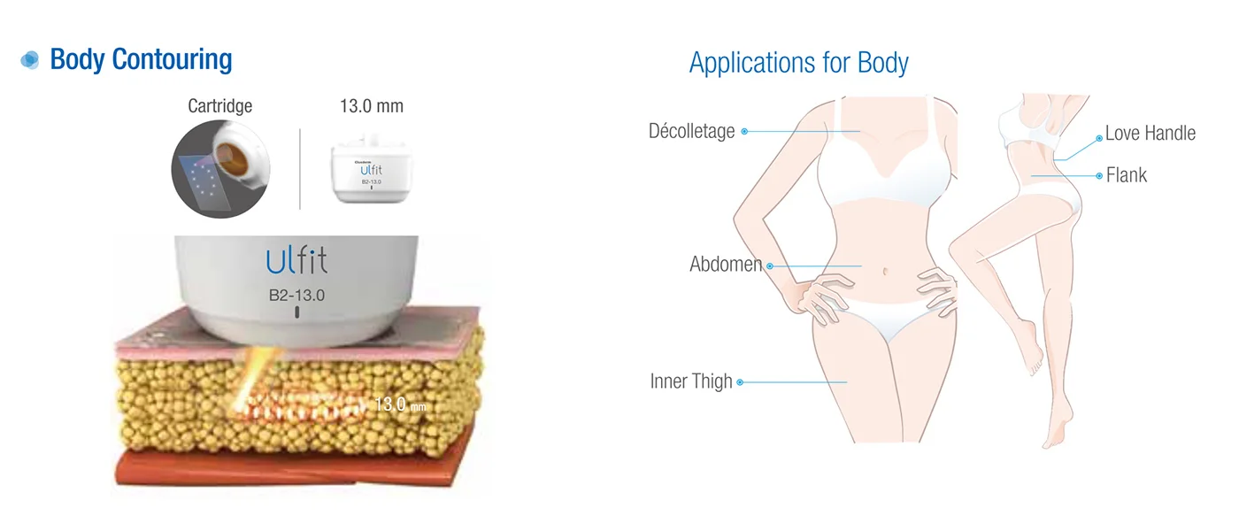 ULFIT HIFU body-contouring.jpg