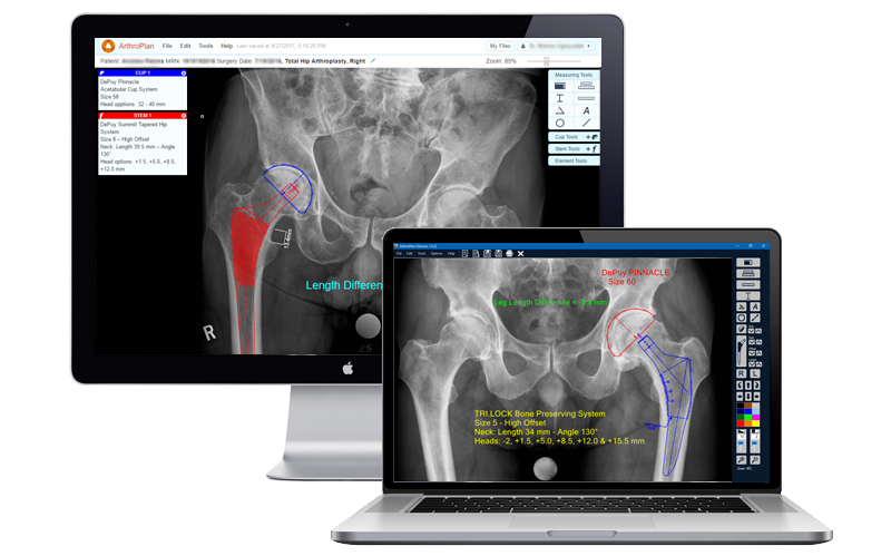 arthroplan_homepag.png