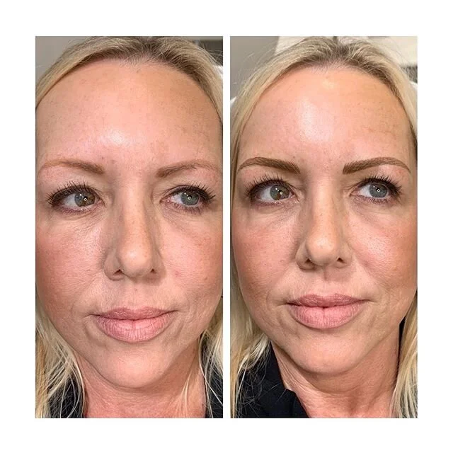 Brows really are the MVP🏆