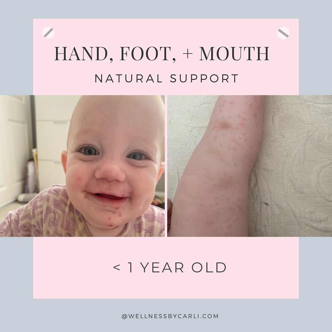 SAVE THIS‼️

Its back to school time and I know you think your child will never get it, but Hand, Foot + Mouth Disease is extremely contagious and you will want to be prepared for if/when the time comes. 

HFM is a 🦠 that presents differently in dif