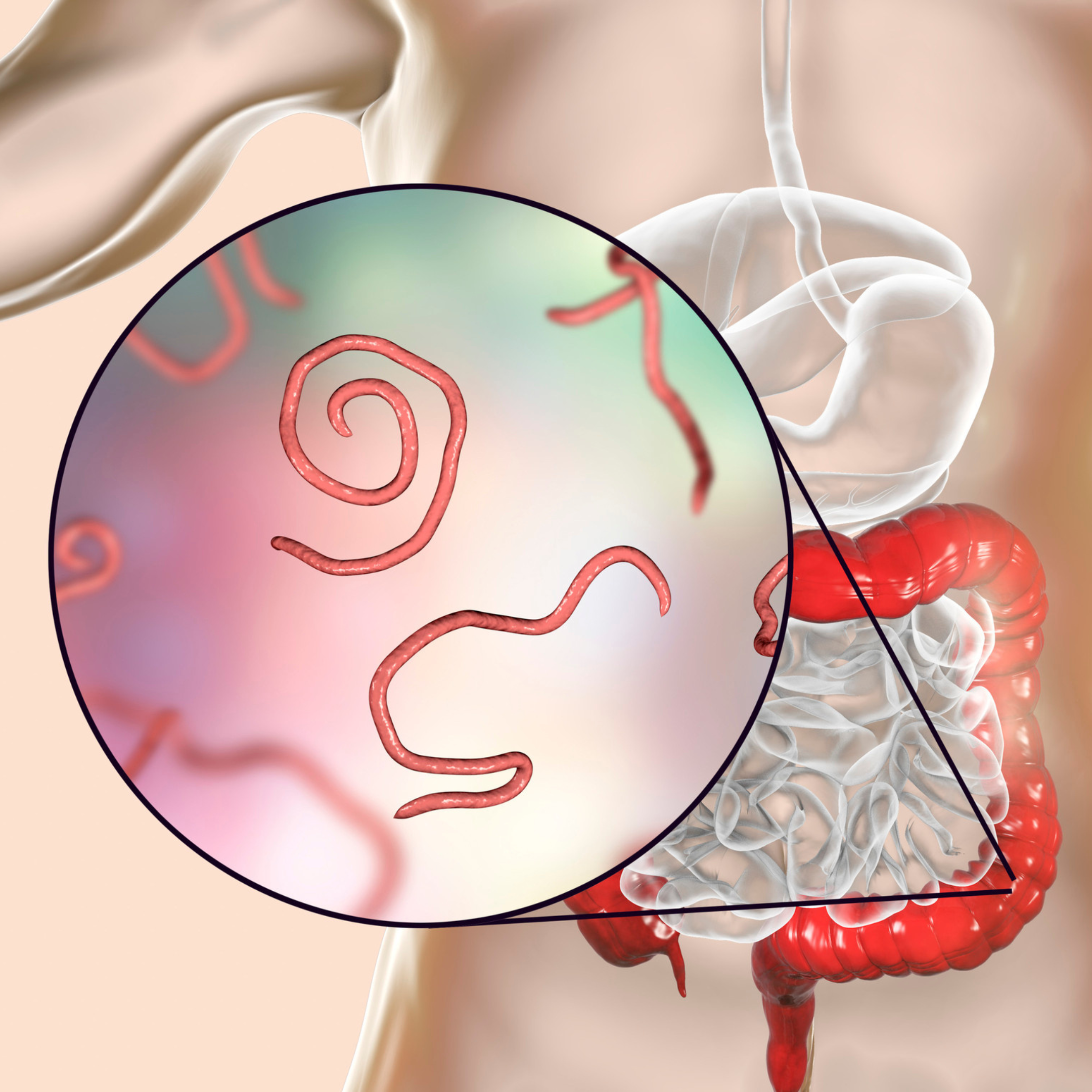 Why is it Important to Do a Parasite Cleanse?