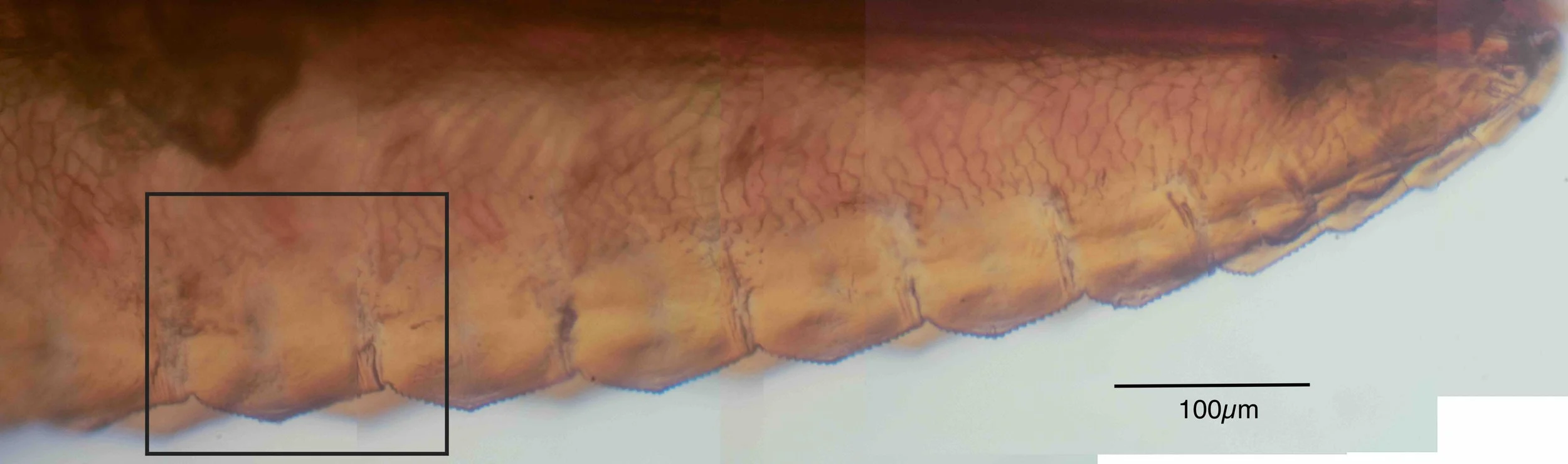 Saw after dissection from insect