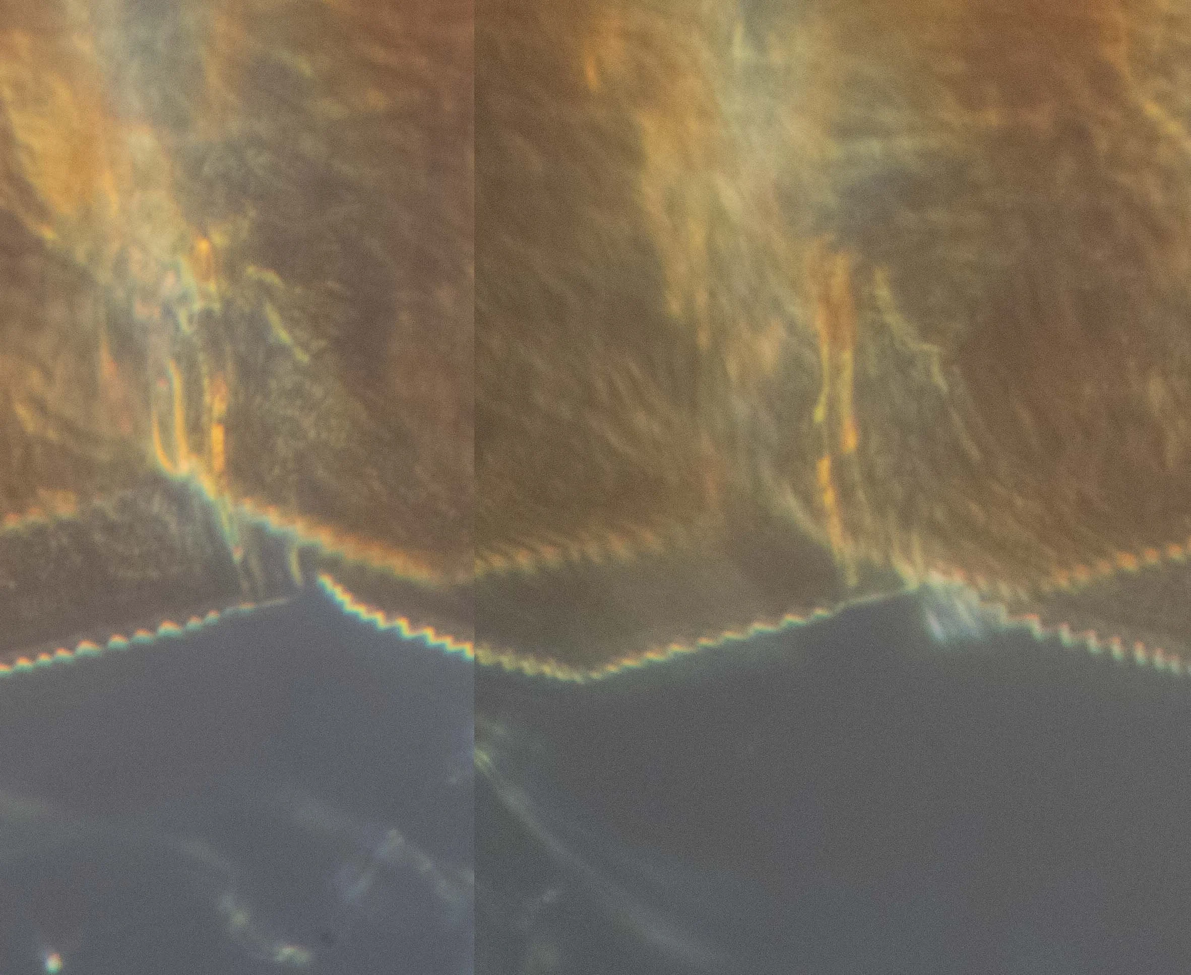 photomicrograph of tooth #10