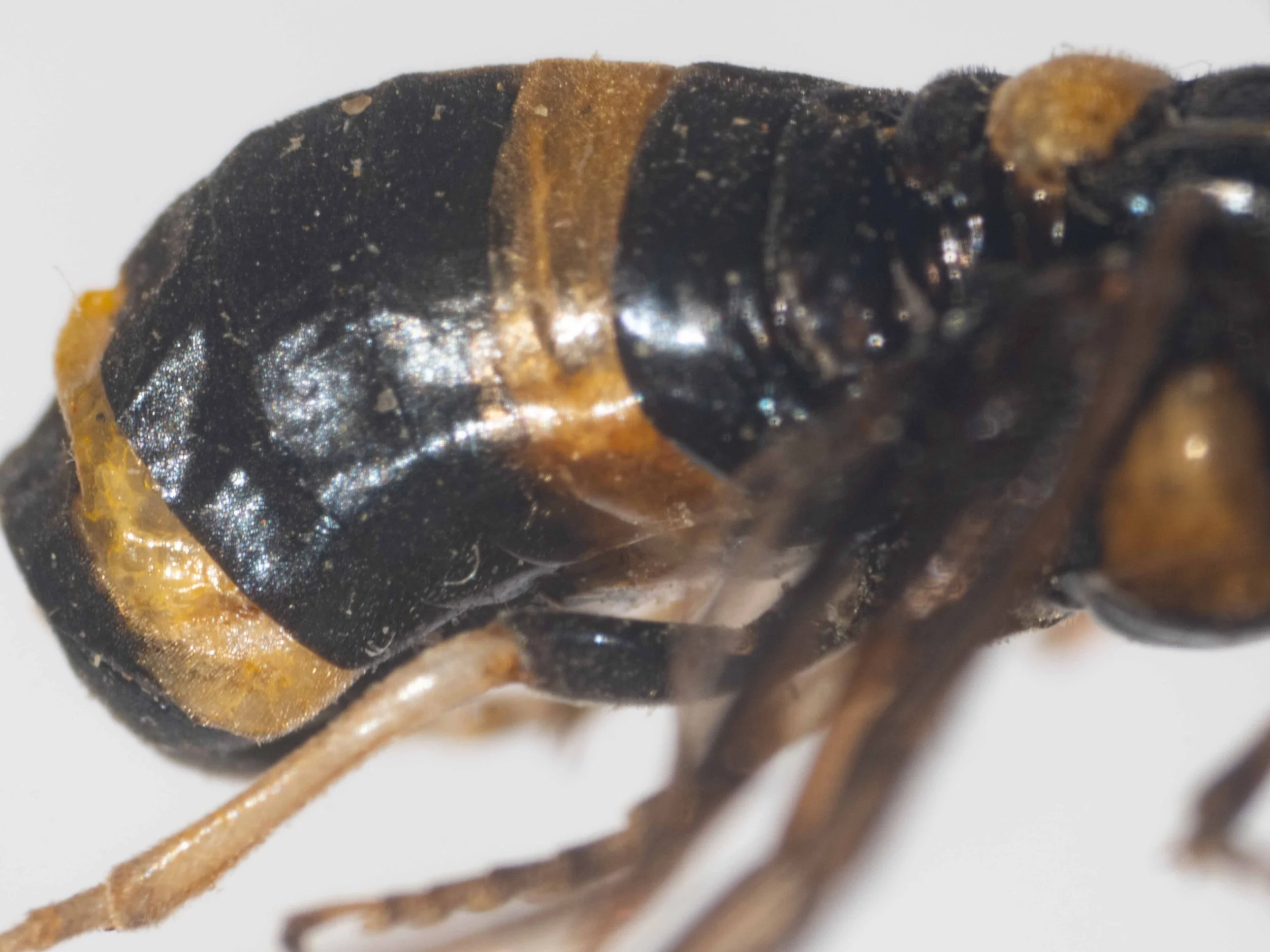 #1 - abdomen lateral view