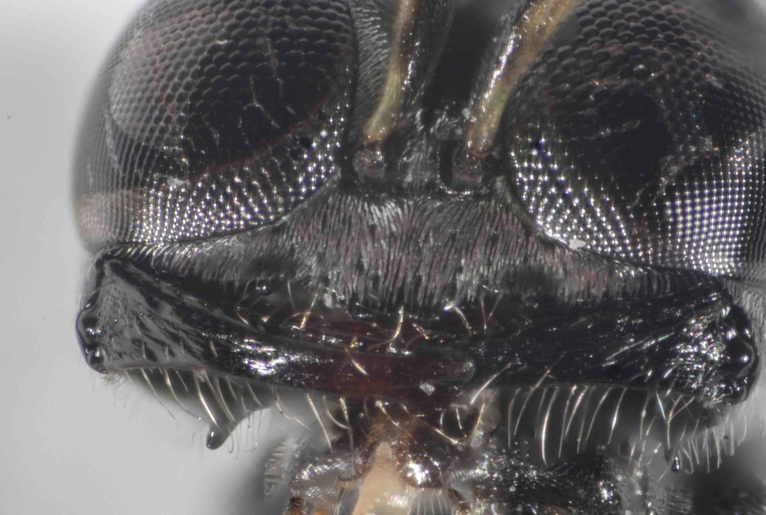 mandible with <3 teeth