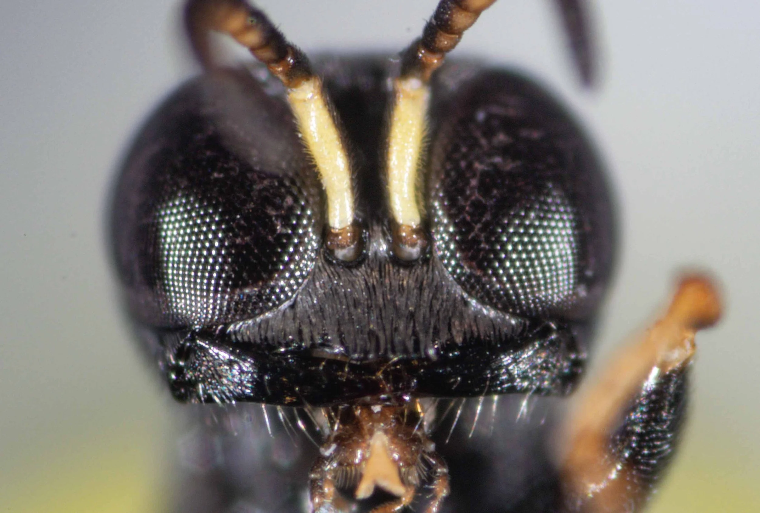 mandible with <3 teeth