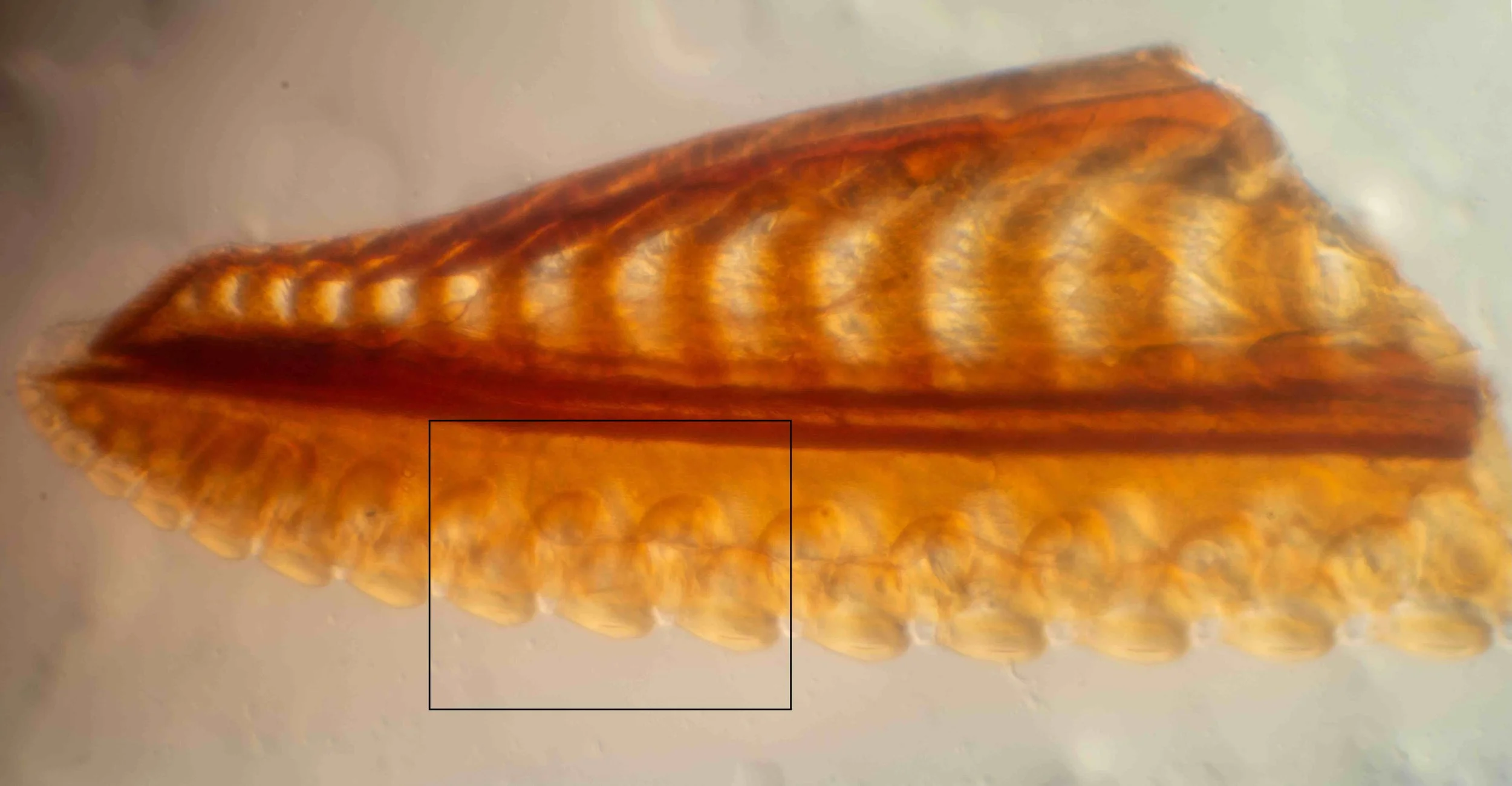 Saw dissected from female