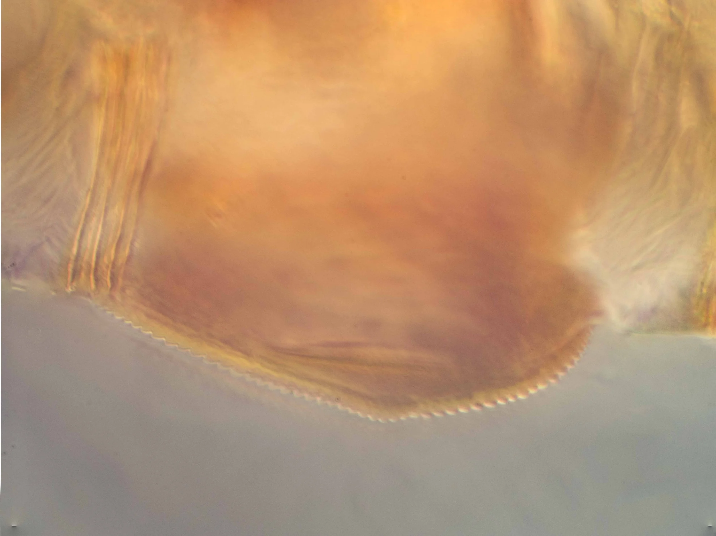 Tooth #10 showing denticulations (serrulae)