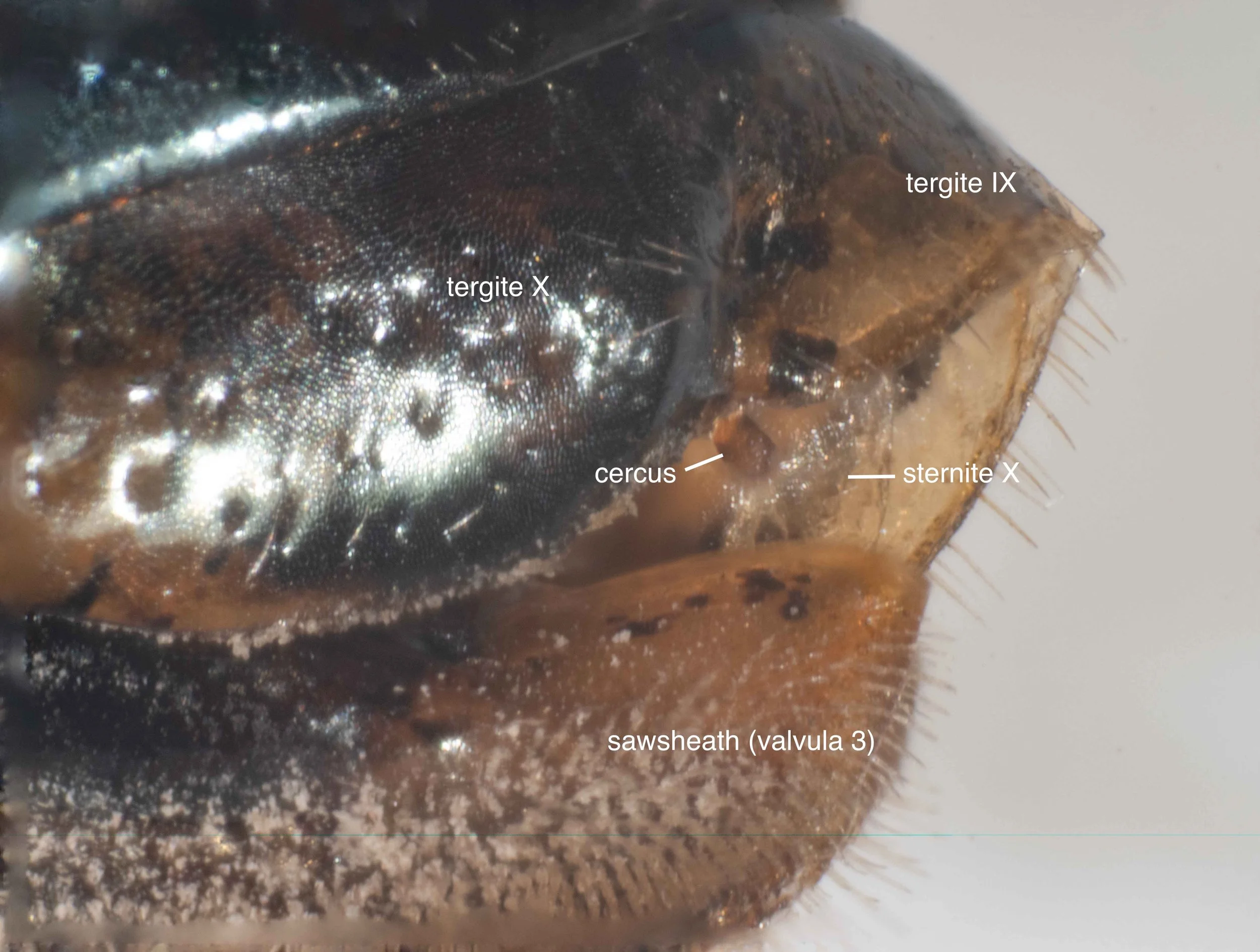   rear of abdomen - lateral view  