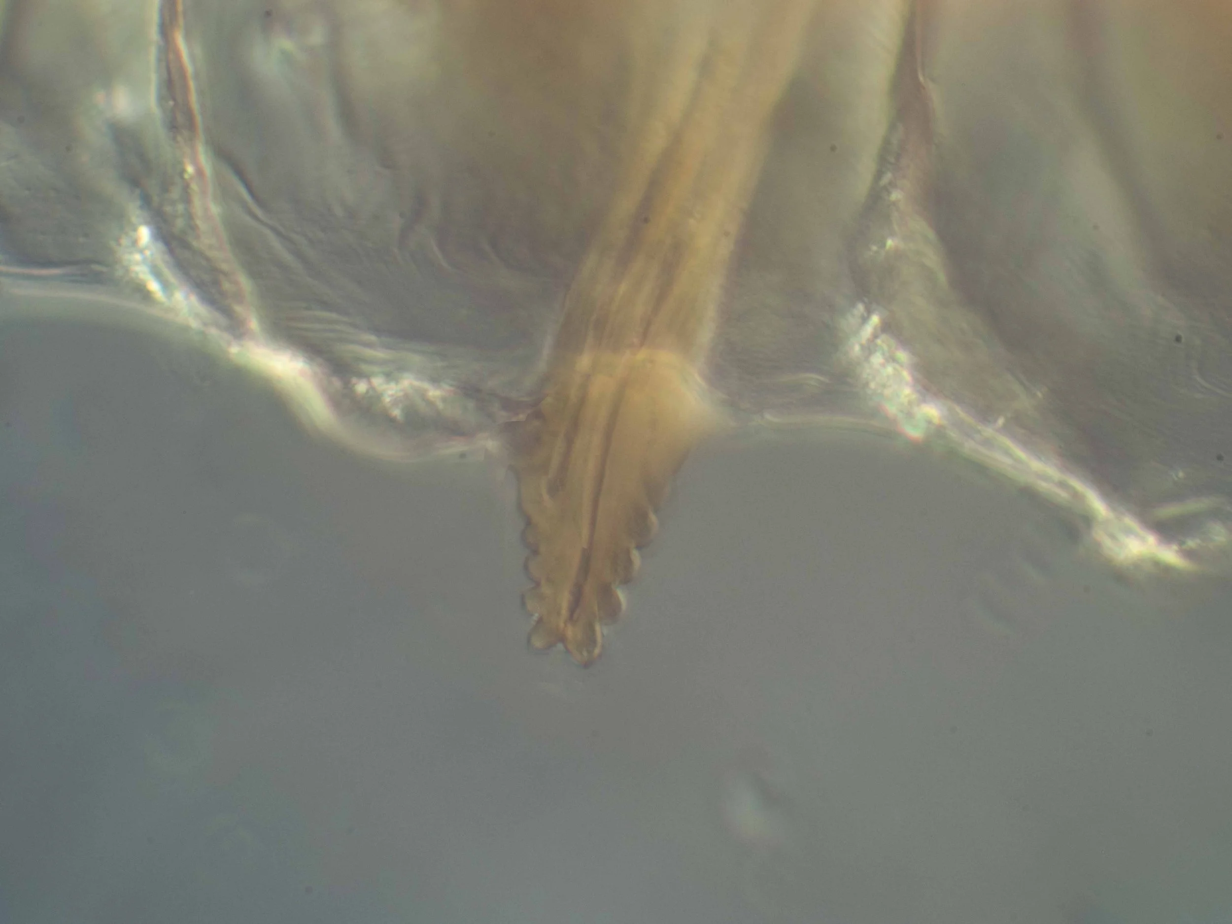  single tooth (serrula) in mid region of lancet 