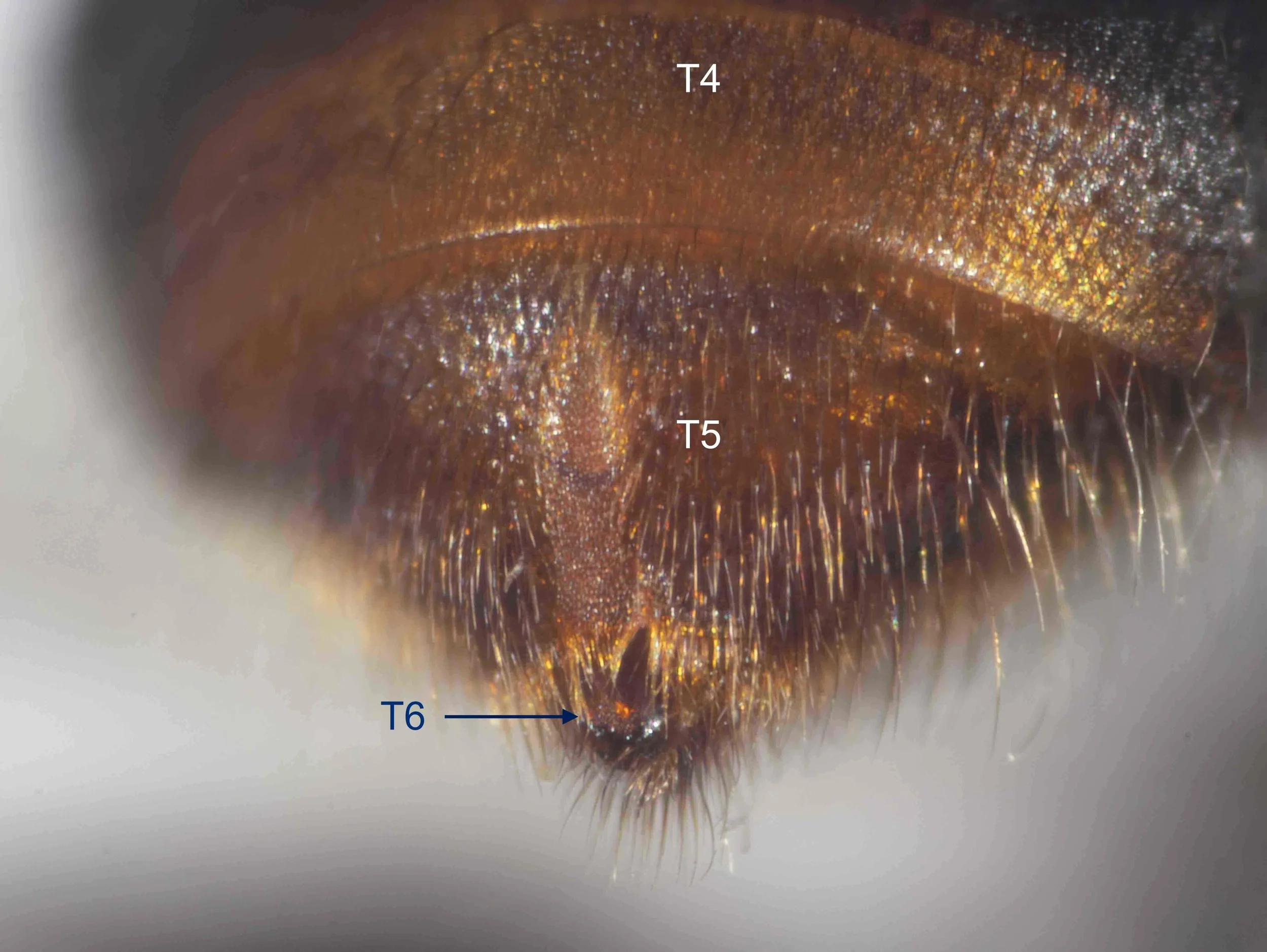  Apex of metasoma, viewed dorsally. 