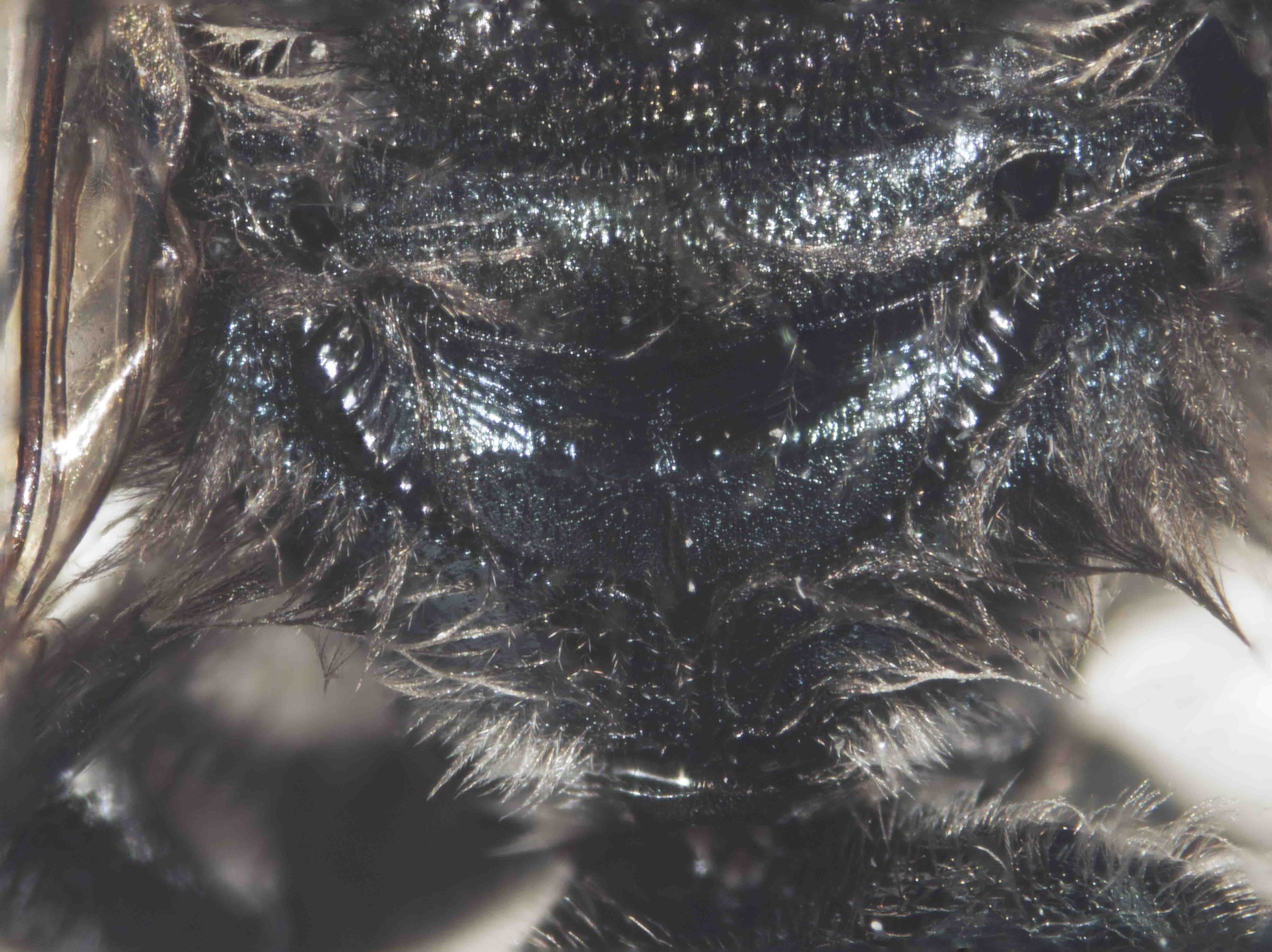  scutellum and dorsal enclosure of propodeum 