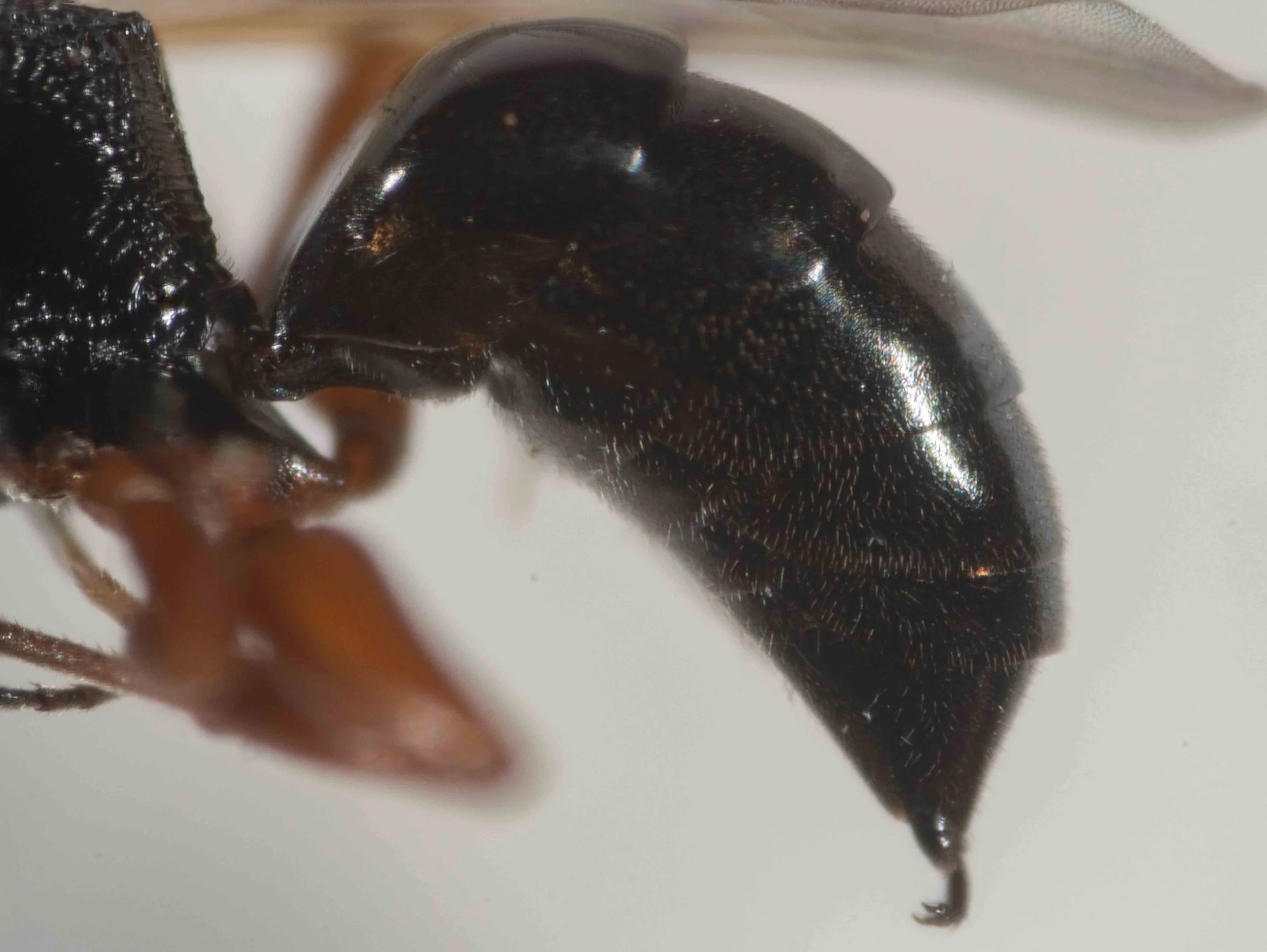 metasoma