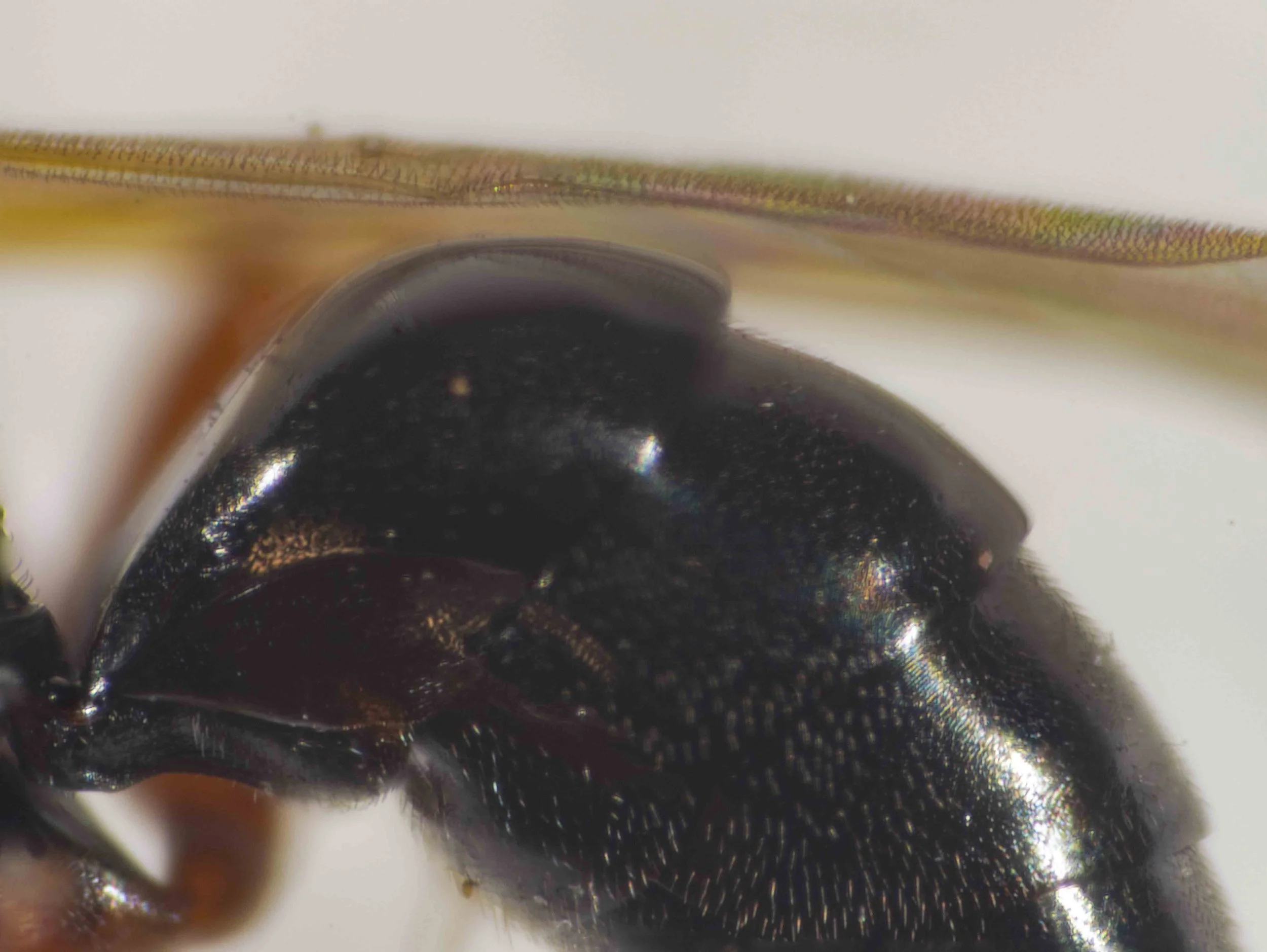 metasoma