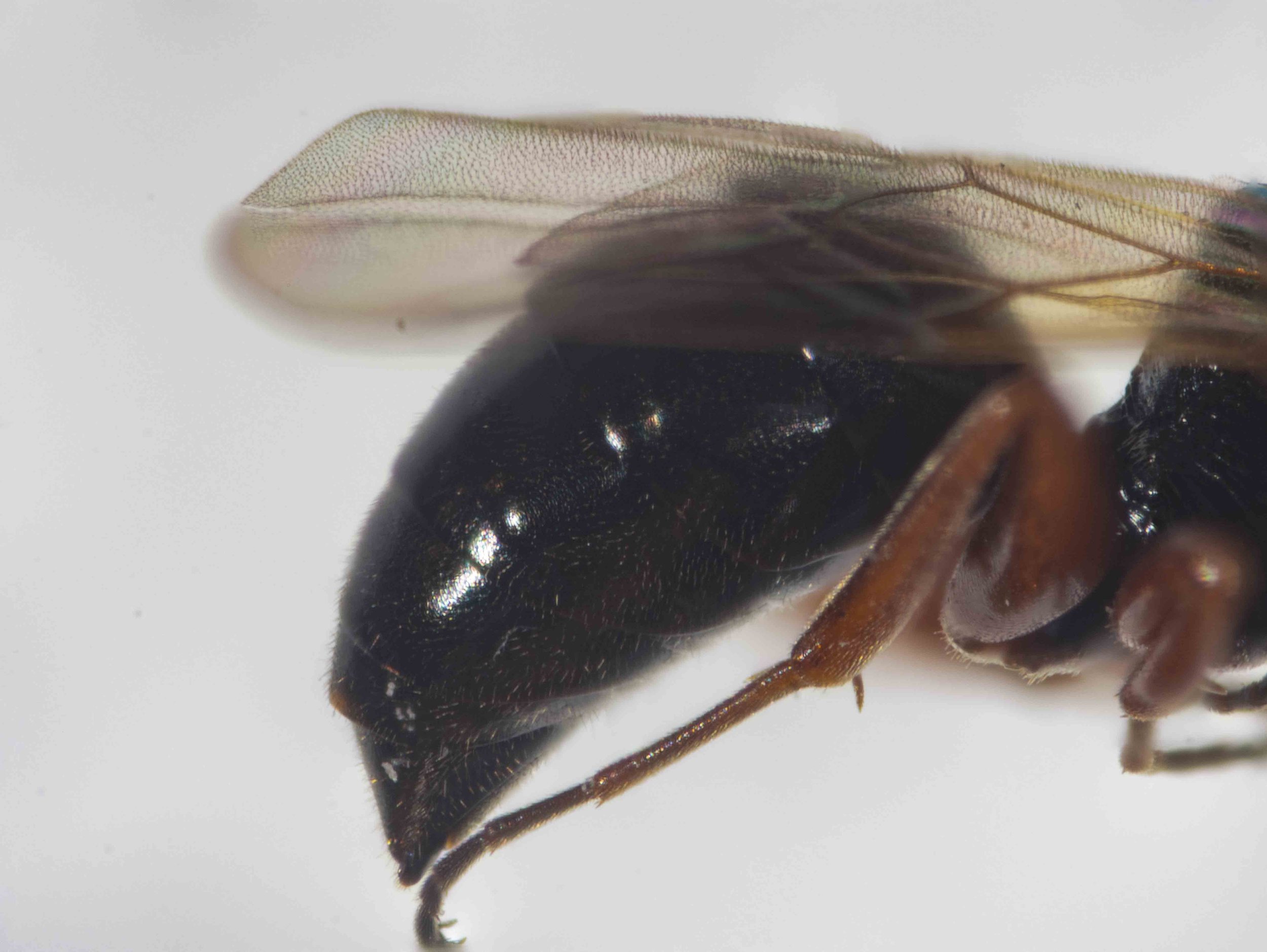 metasoma