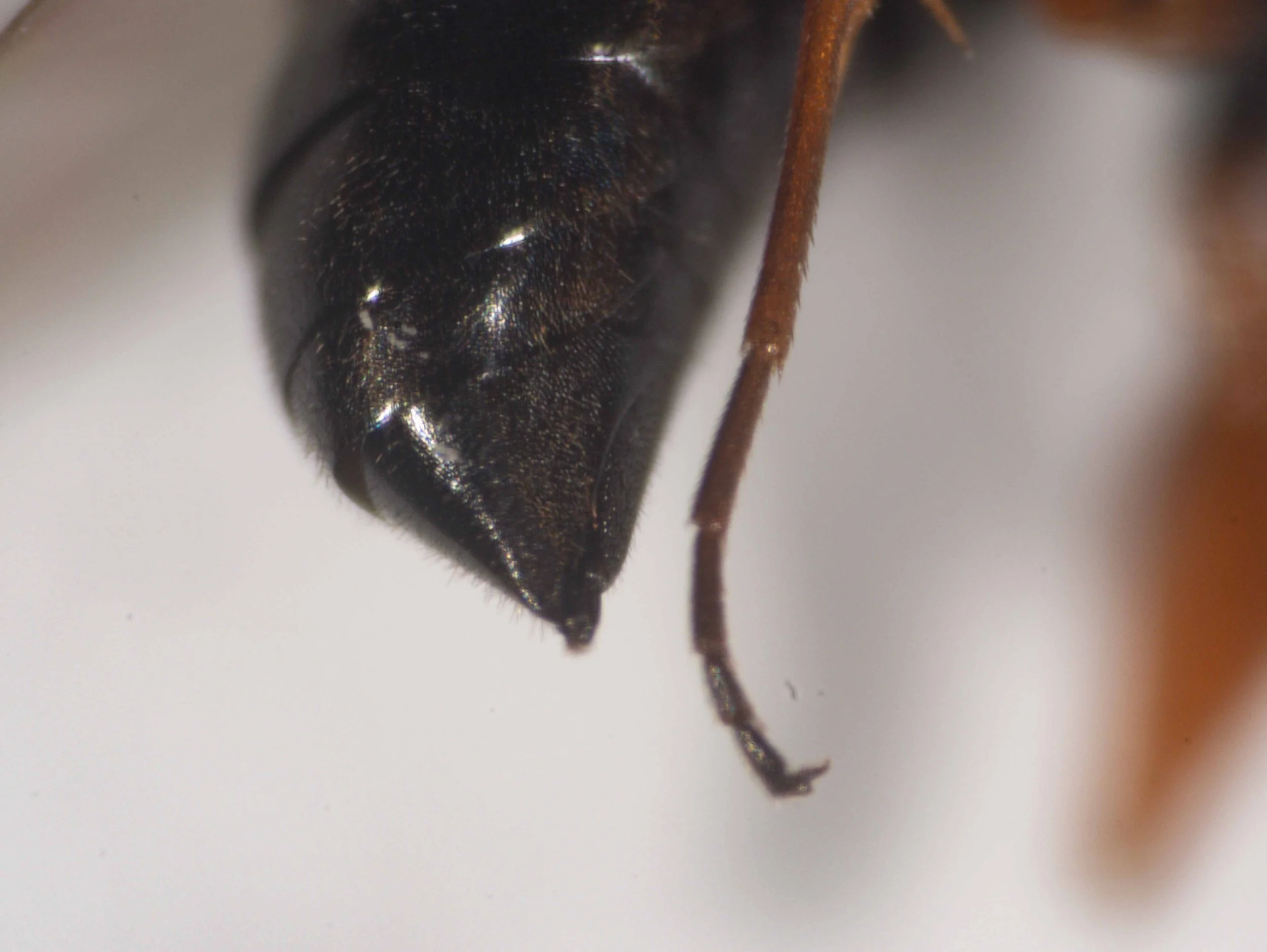 metasoma