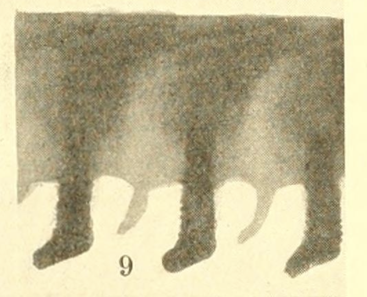  photomicrograph of saw (lancet) of  Pergagrapta polita  - Pl. XIV, Fig. 9 from Morice (1919) 