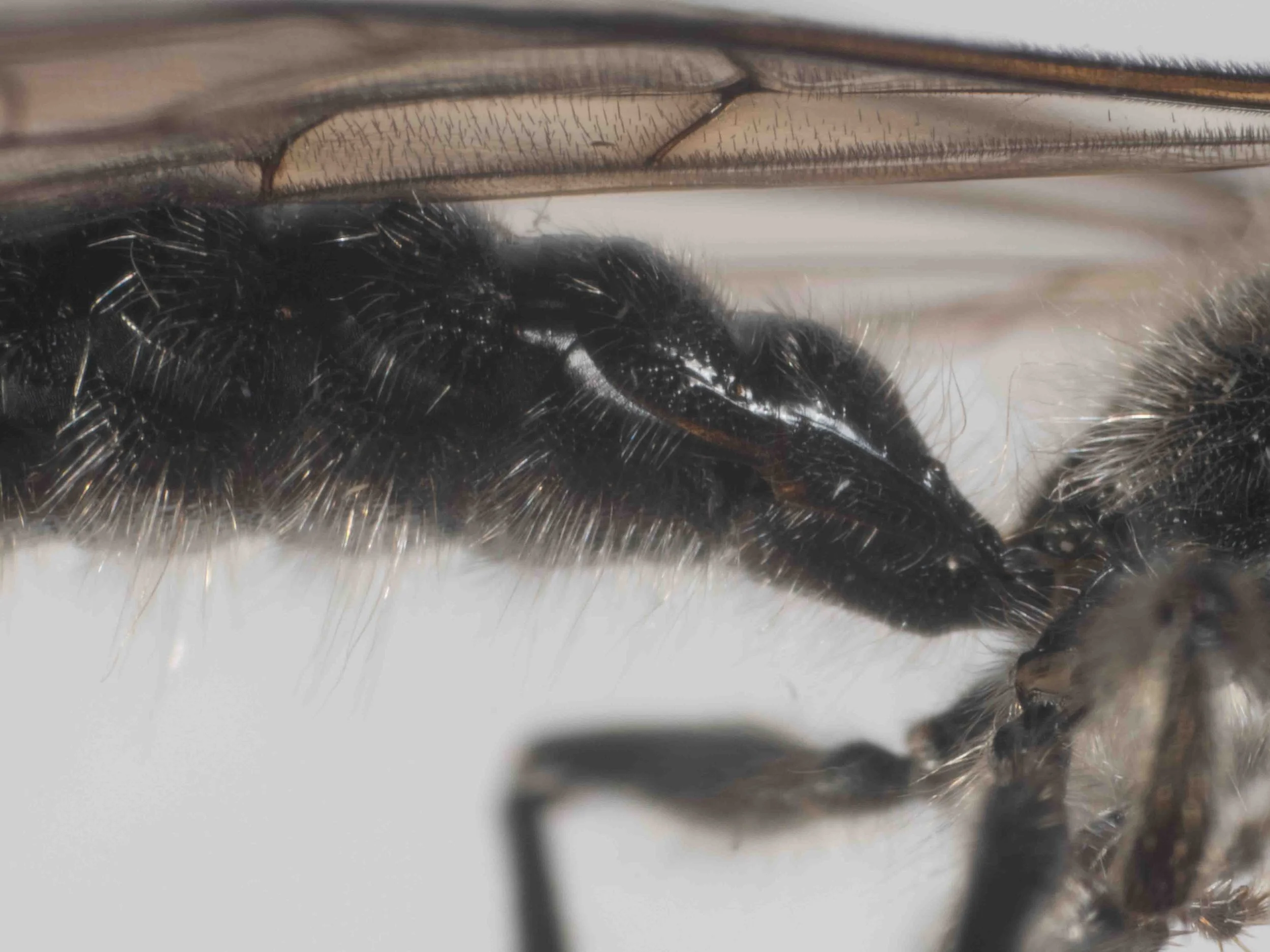 metasoma (lateral view)