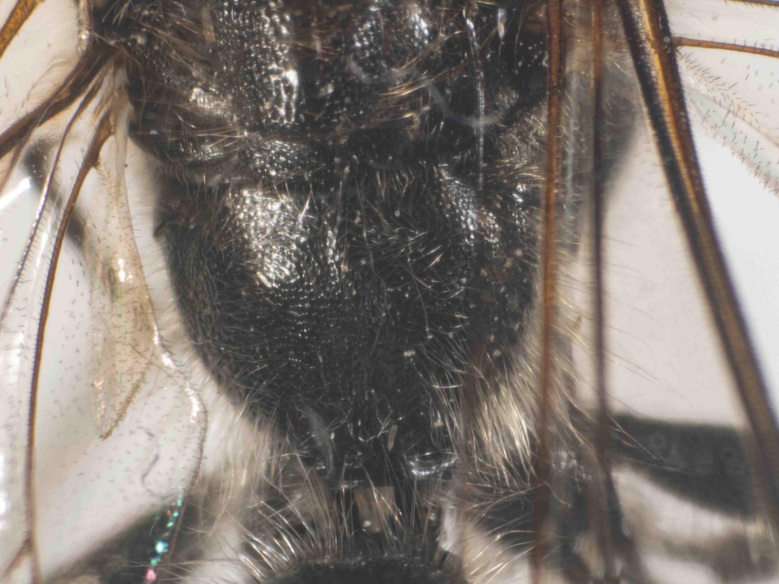 propodeum (dorsal view)
