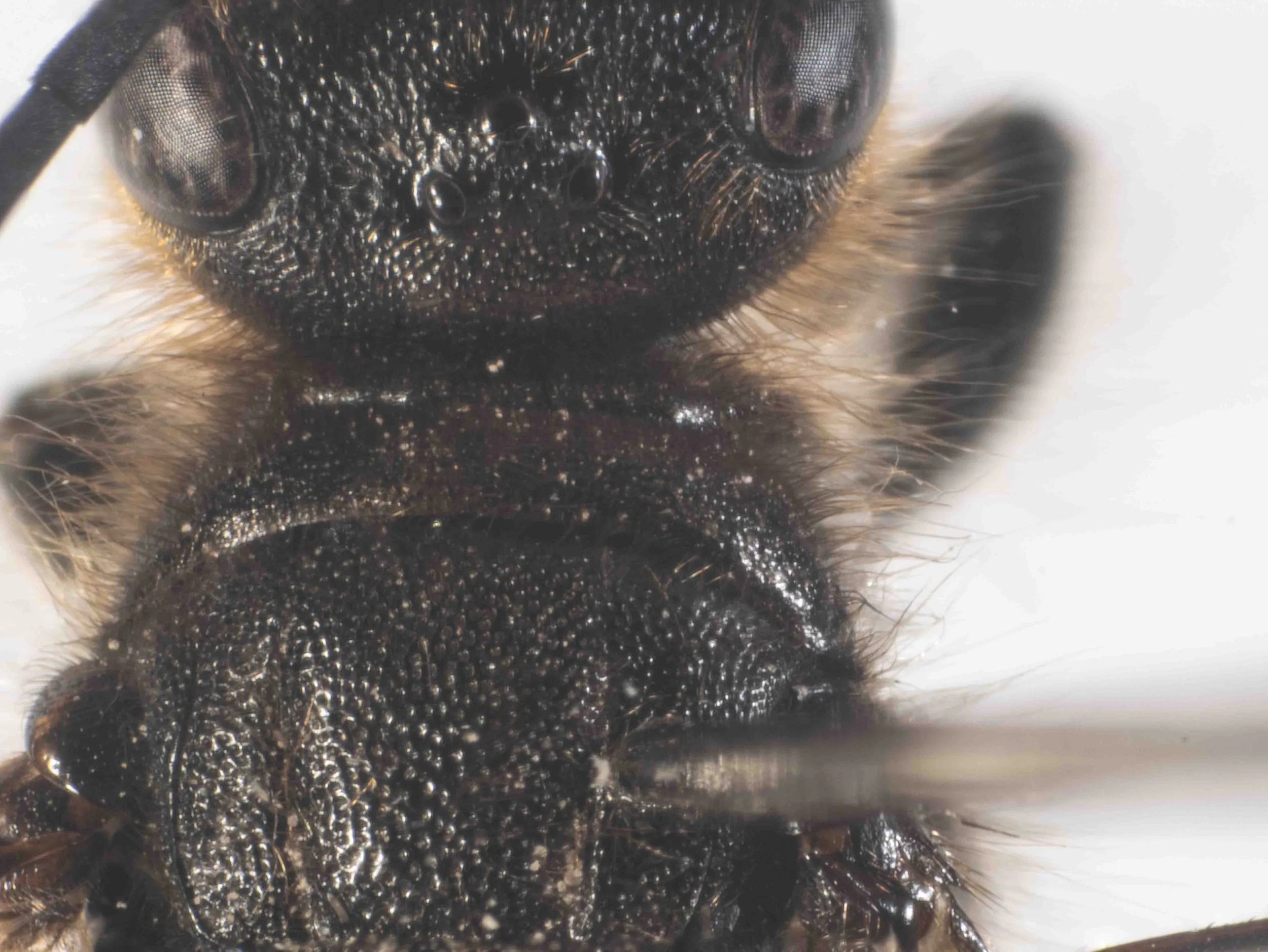 vertex & pronotum (dorsal view)