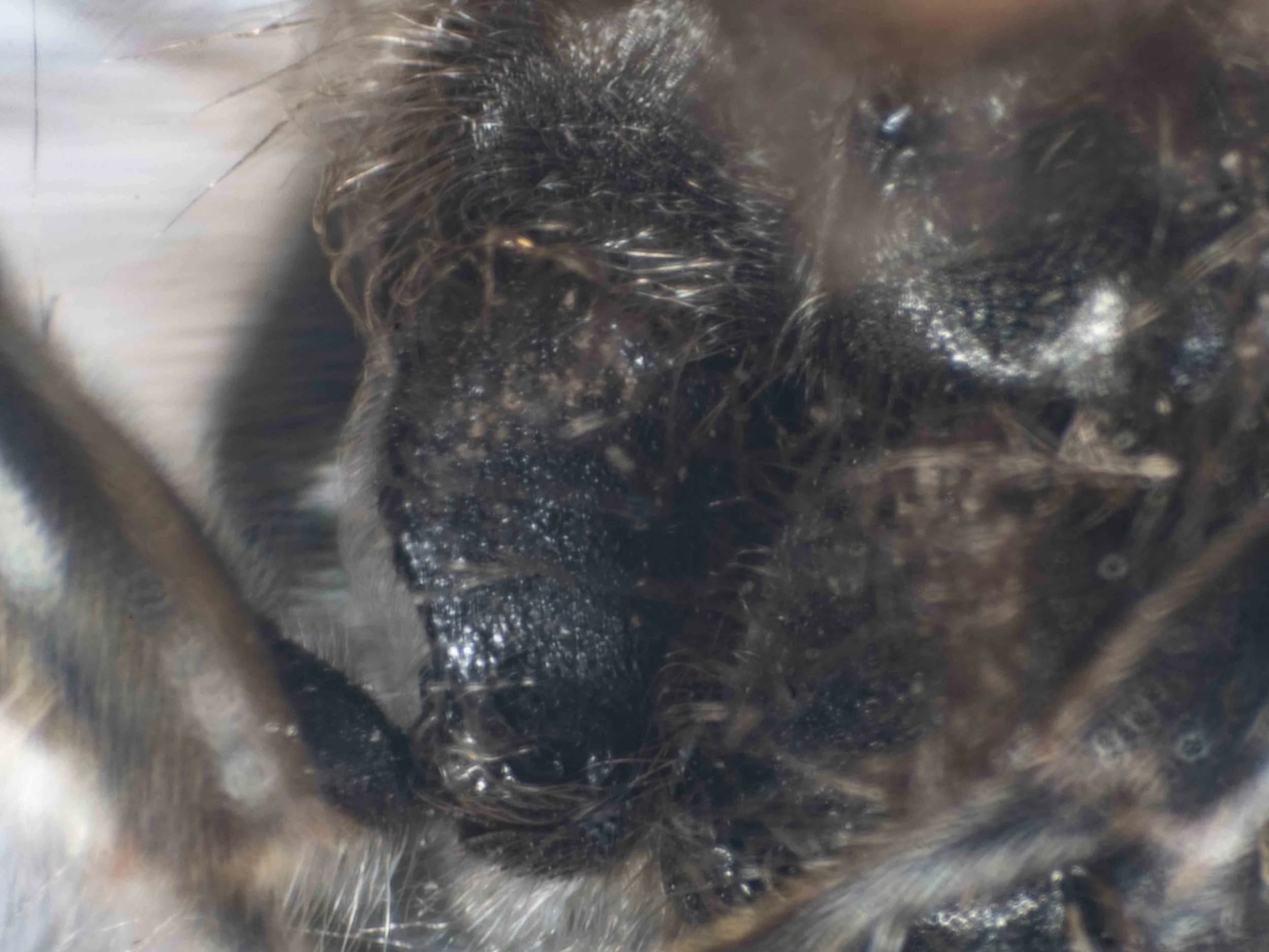 front coxa (ventral view)