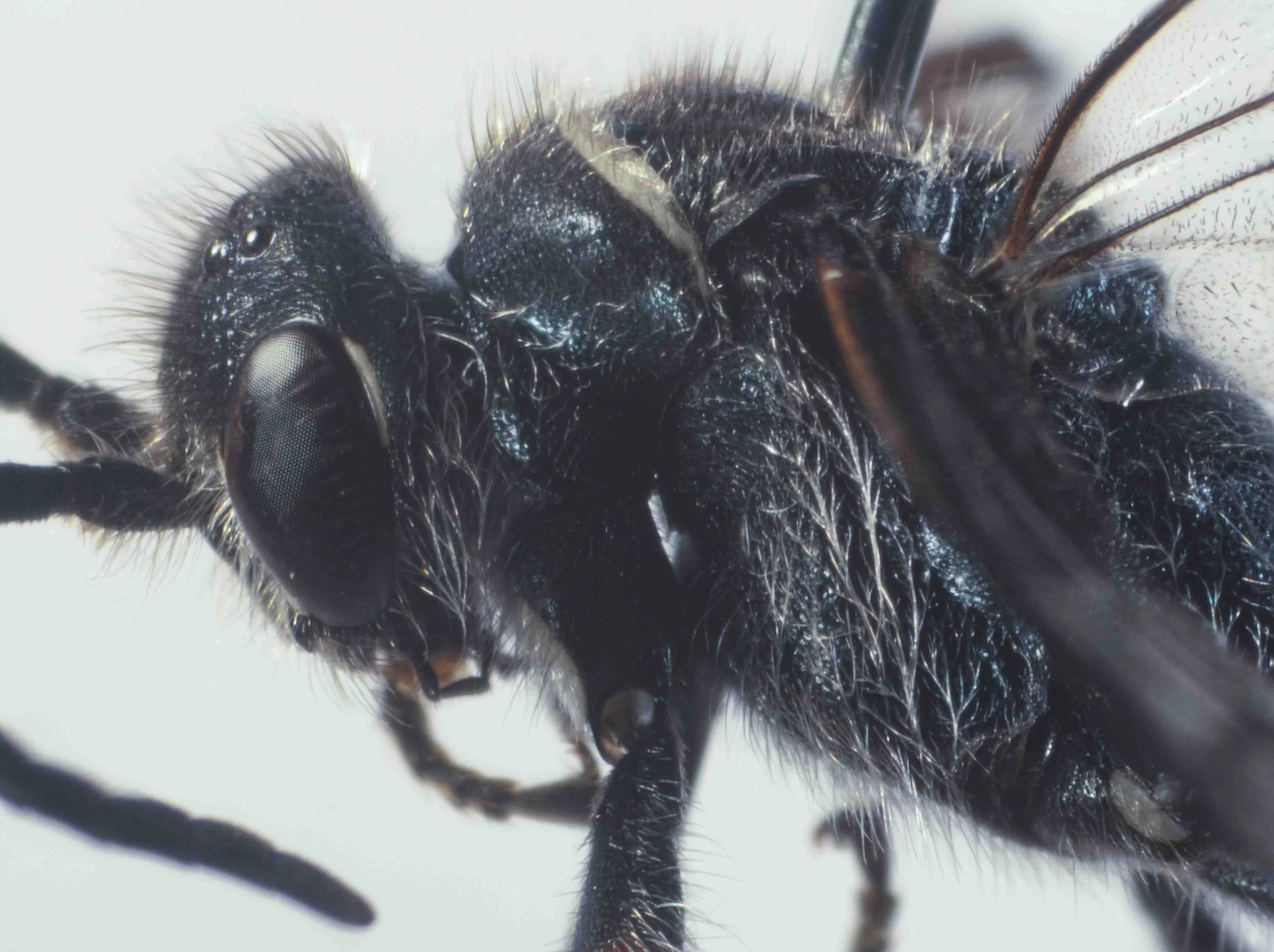 pronotum (viewed laterally)