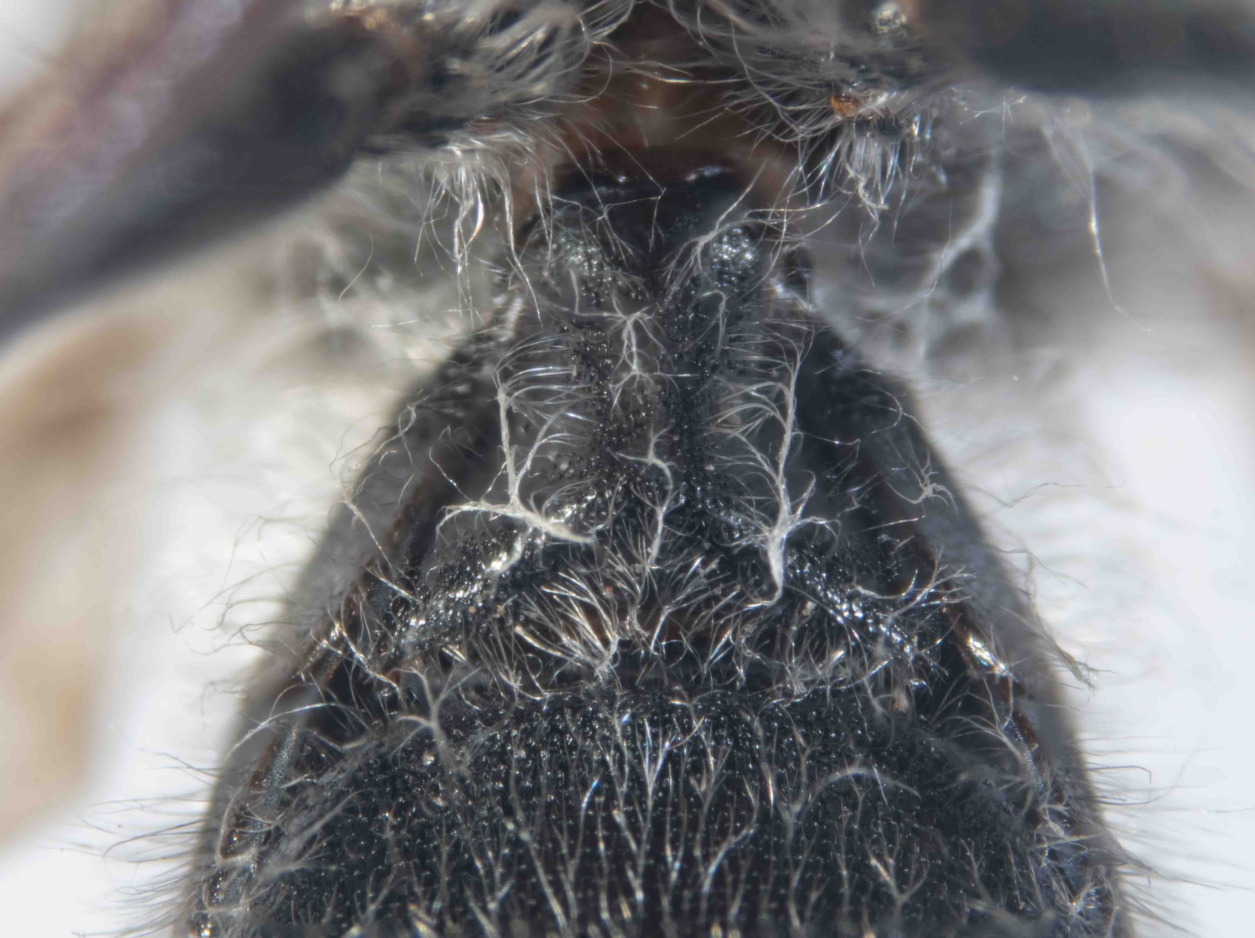 S1 (posteroventral view)