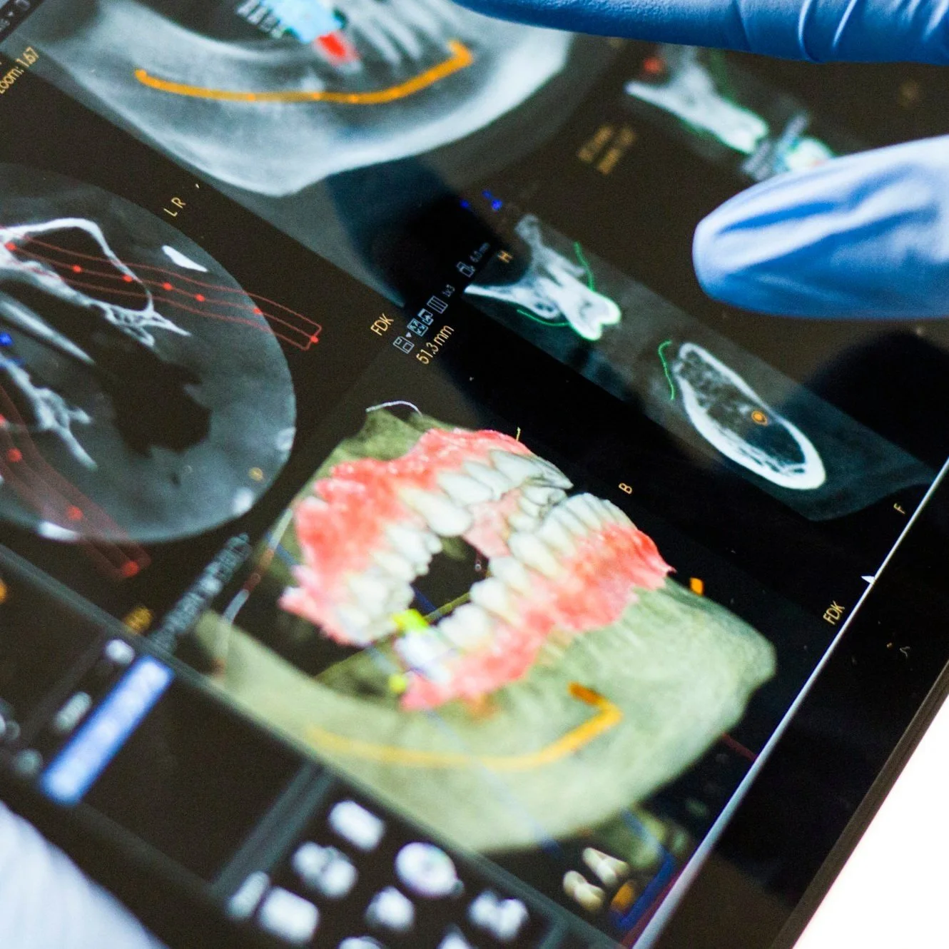 Medical images including dental X-rays and a 3D scan of a mouth and teeth displayed on a computer screen.