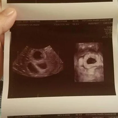 When love is tripled, a story of a single mother and her naturally conceived triplets.