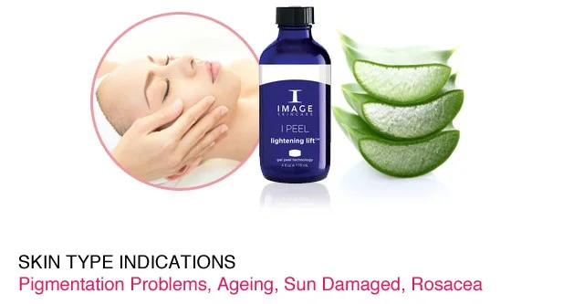 Rosacea.jpg
