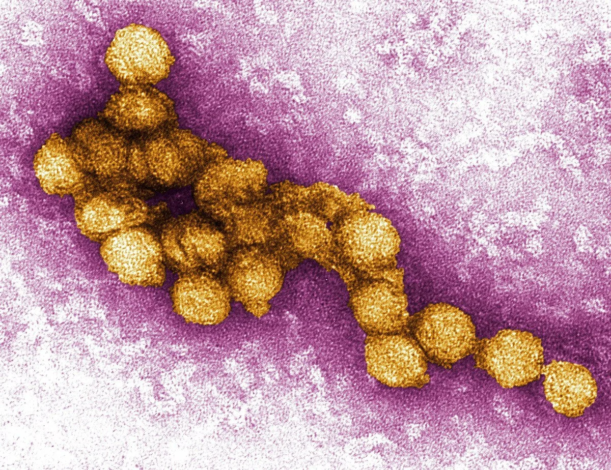 READ: CDC Investigates West Nile Virus