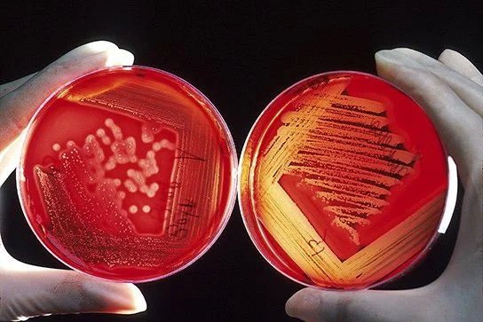 READ: Microbiology: Prokaryotic Diversity